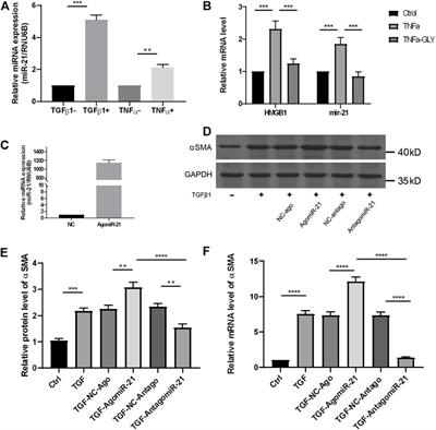 Targeting HMGB1-NFκb Axis and miR-21 by Glycyrrhizin: Role in Amelioration of Corneal Injury in a Mouse Model of Alkali Burn